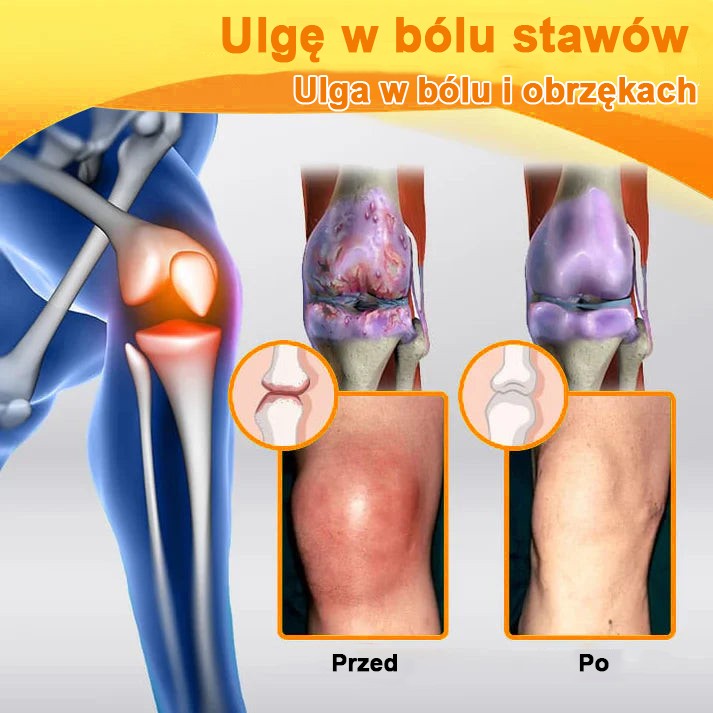 ✅Oficjalny sklep: Ouryard™ Olej magnezowy i miód w sprayu do naprawy stawów👨⚕️Zatwierdzony przez Polską Agencję Leków, Wyrobów Medycznych i Produktów Biologicznych (URPL)🔥