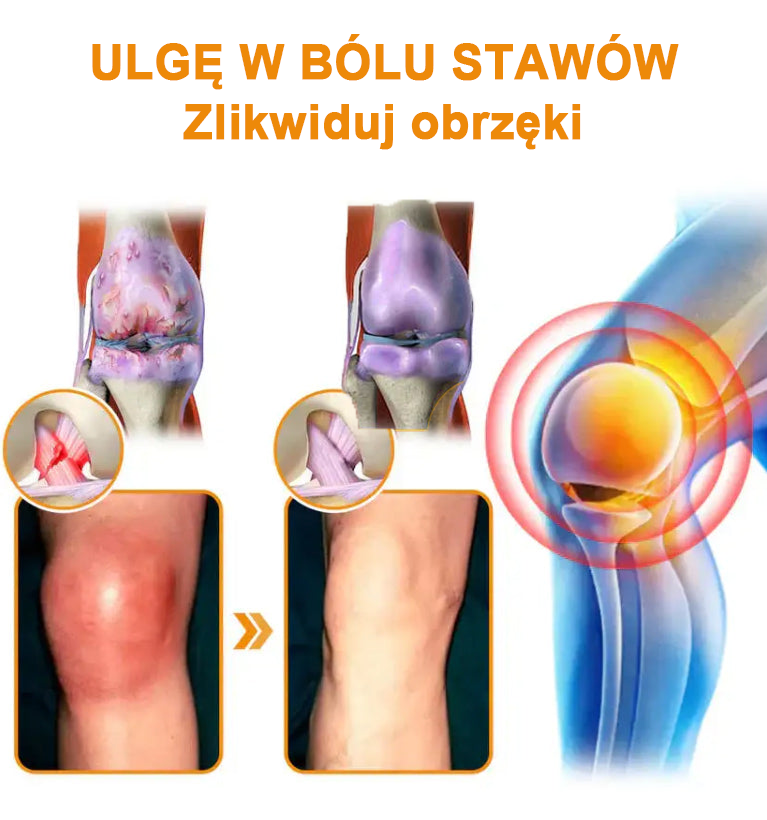 ✅Oficjalny sklep: Ouryard™ Olej magnezowy i miód w sprayu do naprawy stawów👨⚕️Zatwierdzony przez Polską Agencję Leków, Wyrobów Medycznych i Produktów Biologicznych (URPL)🔥