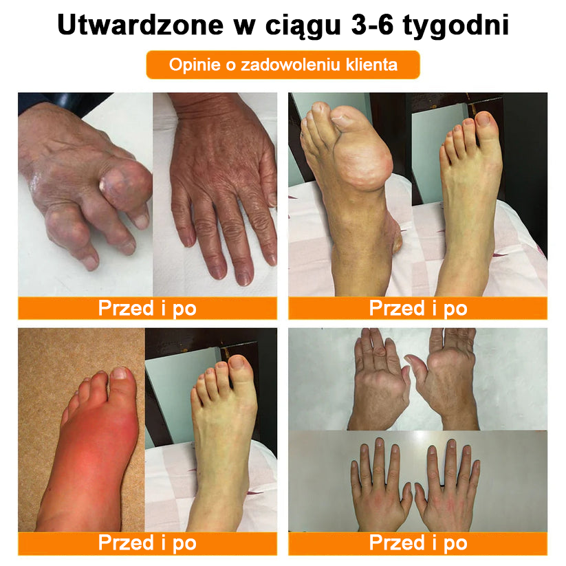 ✅Oficjalny sklep: Ouryard™ Olej magnezowy i miód w sprayu do naprawy stawów👨⚕️Zatwierdzony przez Polską Agencję Leków, Wyrobów Medycznych i Produktów Biologicznych (URPL)🔥