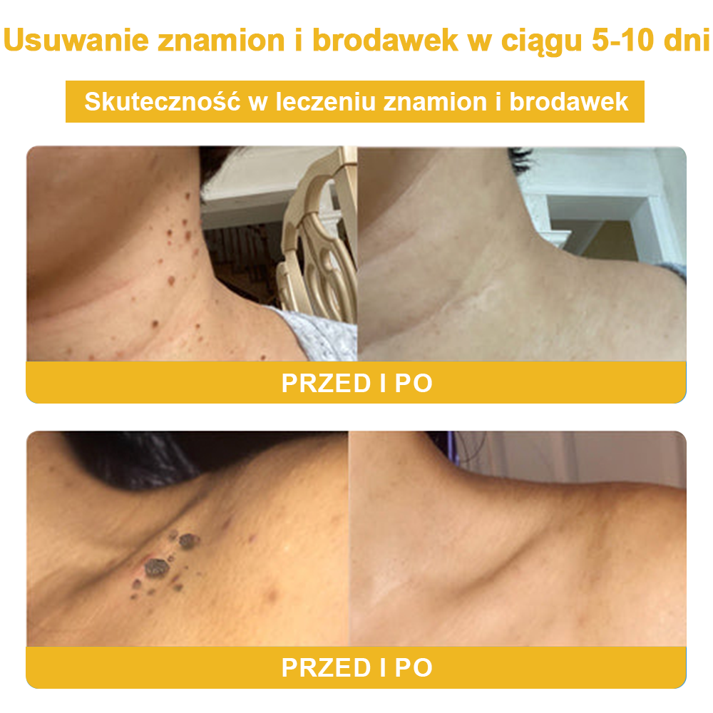 🏵️Turonu™ leczniczy krem do skóry z jadem pszczelim (zalecany przez AAD)🏵️