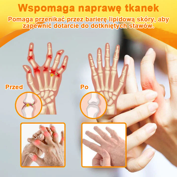 ✅Oficjalny sklep: Ouryard™ Olej magnezowy i miód w sprayu do naprawy stawów👨⚕️Zatwierdzony przez Polską Agencję Leków, Wyrobów Medycznych i Produktów Biologicznych (URPL)🔥