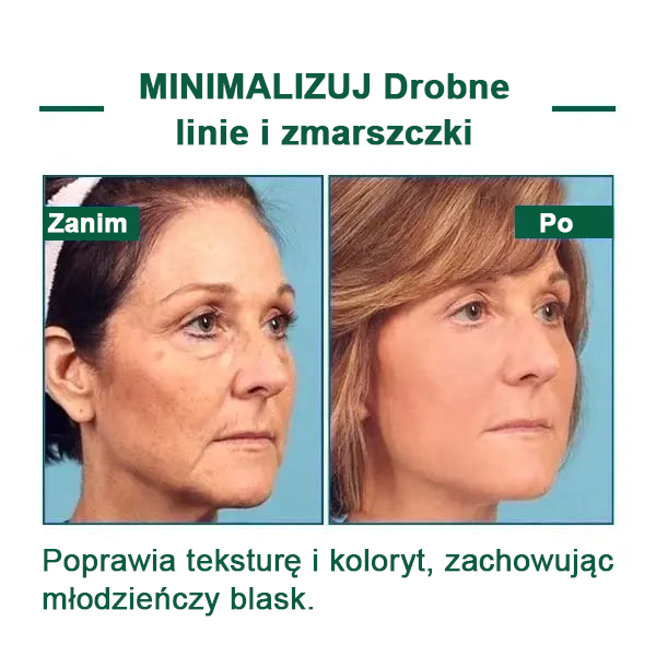 【✨Za pobraniem✨】Wyprzedaż ostatniego dnia 80% taniej - Ujędrniające serum regenerujące Fubsta™✨