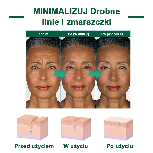 【✨Za pobraniem✨】Wyprzedaż ostatniego dnia 80% taniej - Ujędrniające serum regenerujące Fubsta™✨