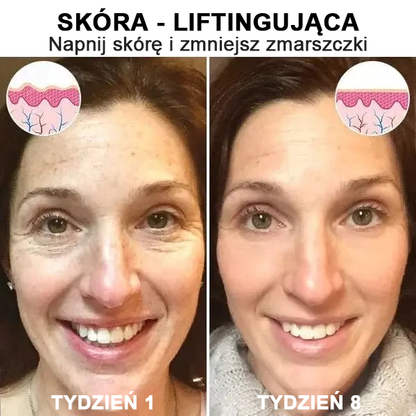 【✨Za pobraniem✨】Wyprzedaż ostatniego dnia 80% taniej - Ujędrniające serum regenerujące Fubsta™✨