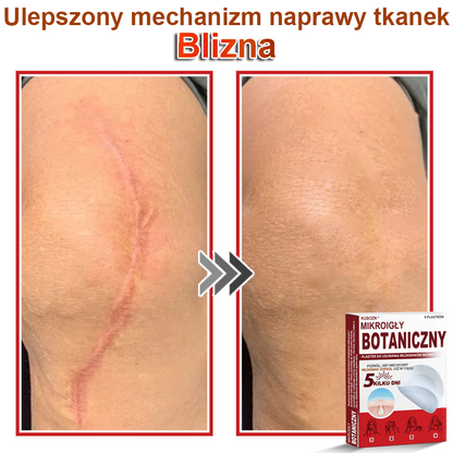 KUBOZN® Mikroigłowy botaniczny środek do usuwania narośli skórnych ✅✅✅wyprodukowano w Polsce