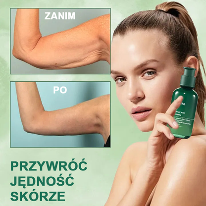 【✨Za pobraniem✨】Wyprzedaż ostatniego dnia 80% taniej - Ujędrniające serum regenerujące Fubsta™✨