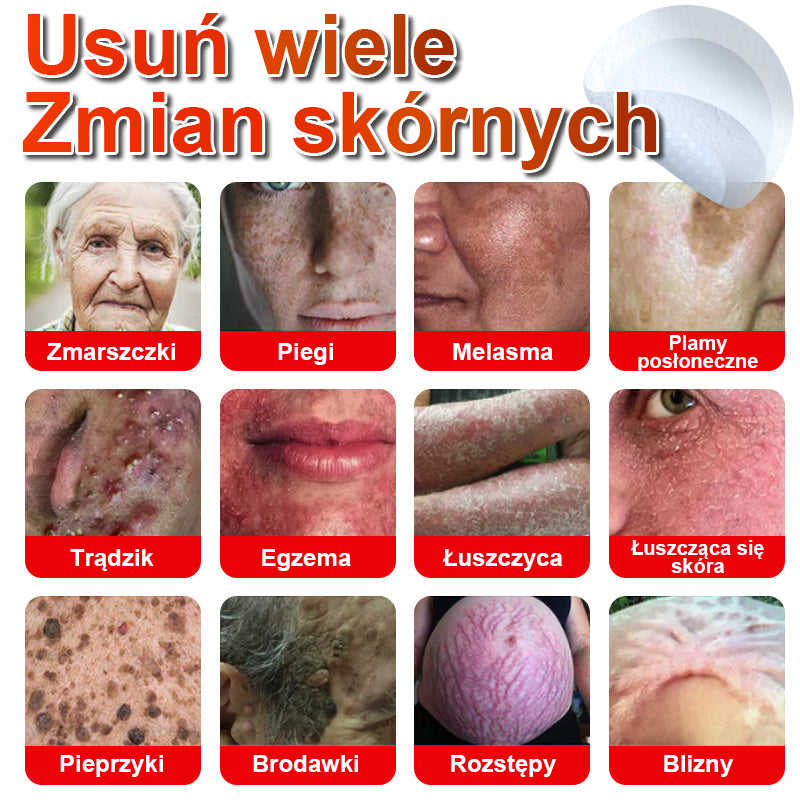 KUBOZN® Mikroigłowy botaniczny środek do usuwania narośli skórnych ✅✅✅wyprodukowano w Polsce