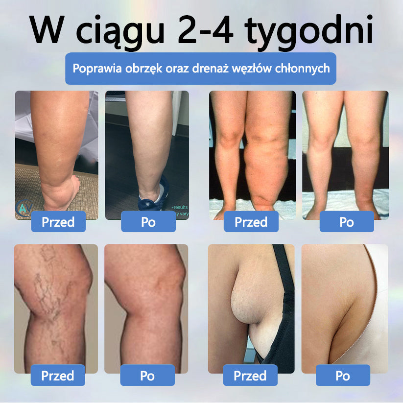 Detoksykujący krem ziołowy z czarnym kminkiem Cvreoz®🩹🩹🩹