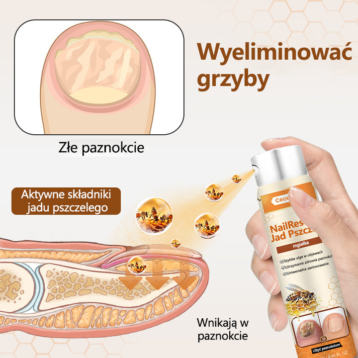 Spray z jadem pszczelim – skuteczny w leczeniu infekcji grzybiczych i zapalenia paznokci🎁🎁