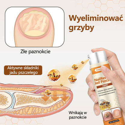 Spray z jadem pszczelim – skuteczny w leczeniu infekcji grzybiczych i zapalenia paznokci🎁🎁