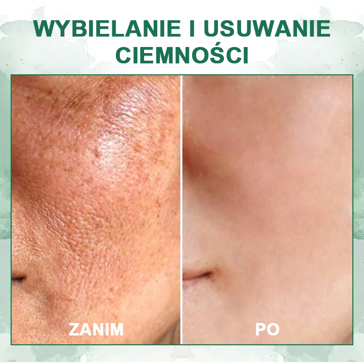 【✨Za pobraniem✨】Wyprzedaż ostatniego dnia 80% taniej - Ujędrniające serum regenerujące Fubsta™✨