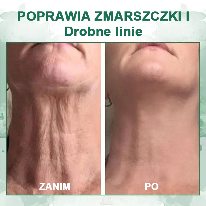 【✨Za pobraniem✨】Wyprzedaż ostatniego dnia 80% taniej - Ujędrniające serum regenerujące Fubsta™✨