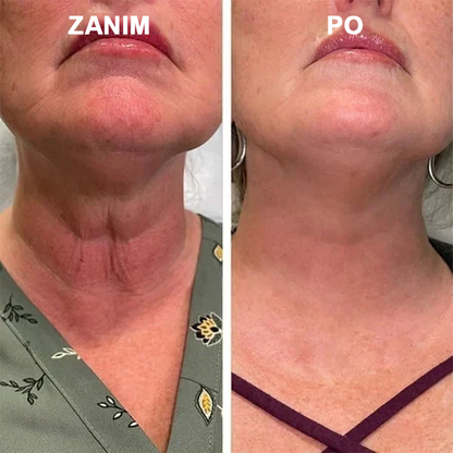 【✨Za pobraniem✨】Wyprzedaż ostatniego dnia 80% taniej - Ujędrniające serum regenerujące Fubsta™✨