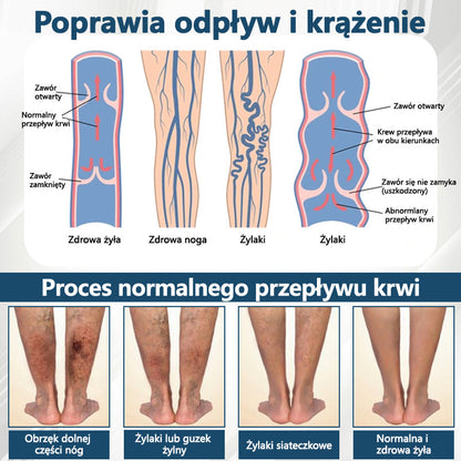 Detoksykujący krem ziołowy z czarnym kminkiem Cvreoz®🩹🩹🩹