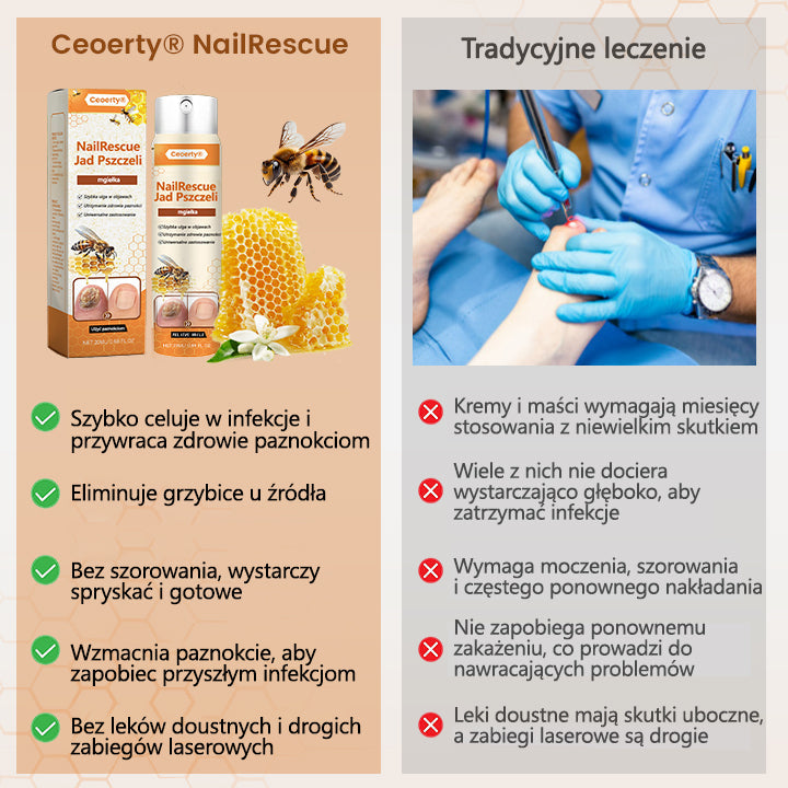 Spray z jadem pszczelim – skuteczny w leczeniu infekcji grzybiczych i zapalenia paznokci🎁🎁