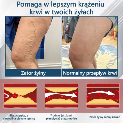 Detoksykujący krem ziołowy z czarnym kminkiem Cvreoz®🩹🩹🩹