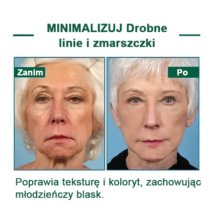 【✨Za pobraniem✨】Wyprzedaż ostatniego dnia 80% taniej - Ujędrniające serum regenerujące Fubsta™✨