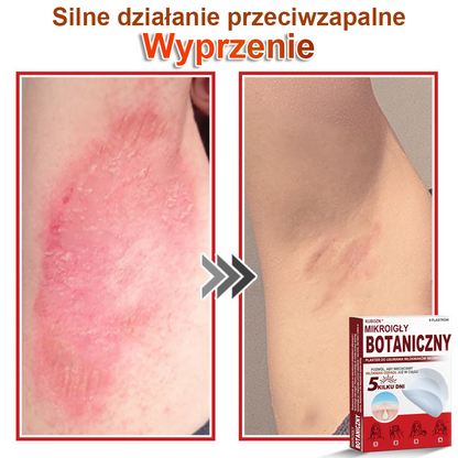 KUBOZN® Mikroigłowy botaniczny środek do usuwania narośli skórnych ✅✅✅wyprodukowano w Polsce