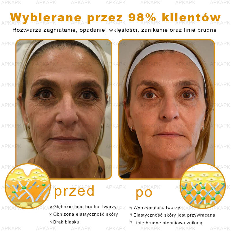ΑPΚΑPK™ Jad Pszczoły Kompleksowy Krem🥇🥇pomaga w leczeniu problemów skórnych, takich jak: zmarszczki, blizny, plamy pigmentacyjne, rozstępy, trądzik, łuszczyca, egzema, zmiany skórne, podrażnienia, stany zapalne i inne problemy skórne🔥🔥🔥