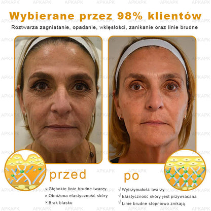 ΑPΚΑPK™ Jad Pszczoły Kompleksowy Krem🥇🥇pomaga w leczeniu problemów skórnych, takich jak: zmarszczki, blizny, plamy pigmentacyjne, rozstępy, trądzik, łuszczyca, egzema, zmiany skórne, podrażnienia, stany zapalne i inne problemy skórne🔥🔥🔥